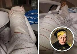 La atleta Carmen Corujo, a punto de morir atacada por dos perros cuando entrenaba en Gijón