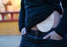 La falta de bolsas de orina es «crítica»: «Se llegan a lavar para poder reutilizarlas»