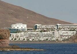 El PSOE recurre el plácet al hotel Papagayo