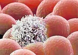 Persiguiendo las huellas del cáncer de mama: el vecino que nadie quiere