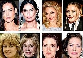 Midorexia o cómo el pánico a envejecer puede destrozarte la cara