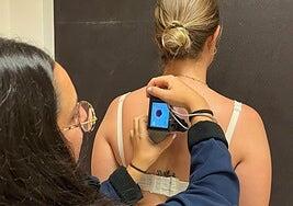 Sanidad usa el pilotaje del servicio de teledermatología en los centros de salud