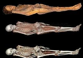 El hombre de Erques: las claves para entender el valor de esta momia