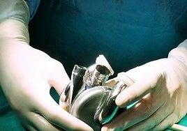 Un hombre vive 100 días con un corazón de titanio