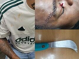 La Policía detiene al presunto autor de un apuñalamiento en la pasada madrugada