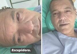 Frank Cuesta, «fuera de peligro» tras ser atacado por una cobra