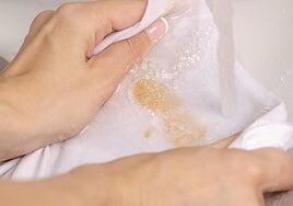 Cómo acabar con las clásicas manchas de verano