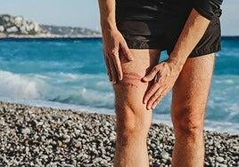 Qué hacer si te pica una medusa