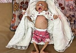 La hambruna en Gaza se agrava con 10 niños muertos más y extiende la indignación contra Israel