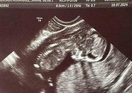 Escarlett ya es persona: la jueza de la dana ordena inscribir en el Registro Civil a la víctima 229