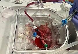 Prueban en cerdos una técnica pionera para reparar los órganos antes de un trasplante