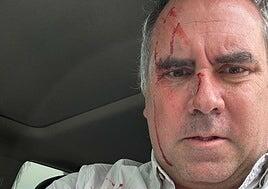 Un candidato presidencial de Perú sobrevive a un atentado