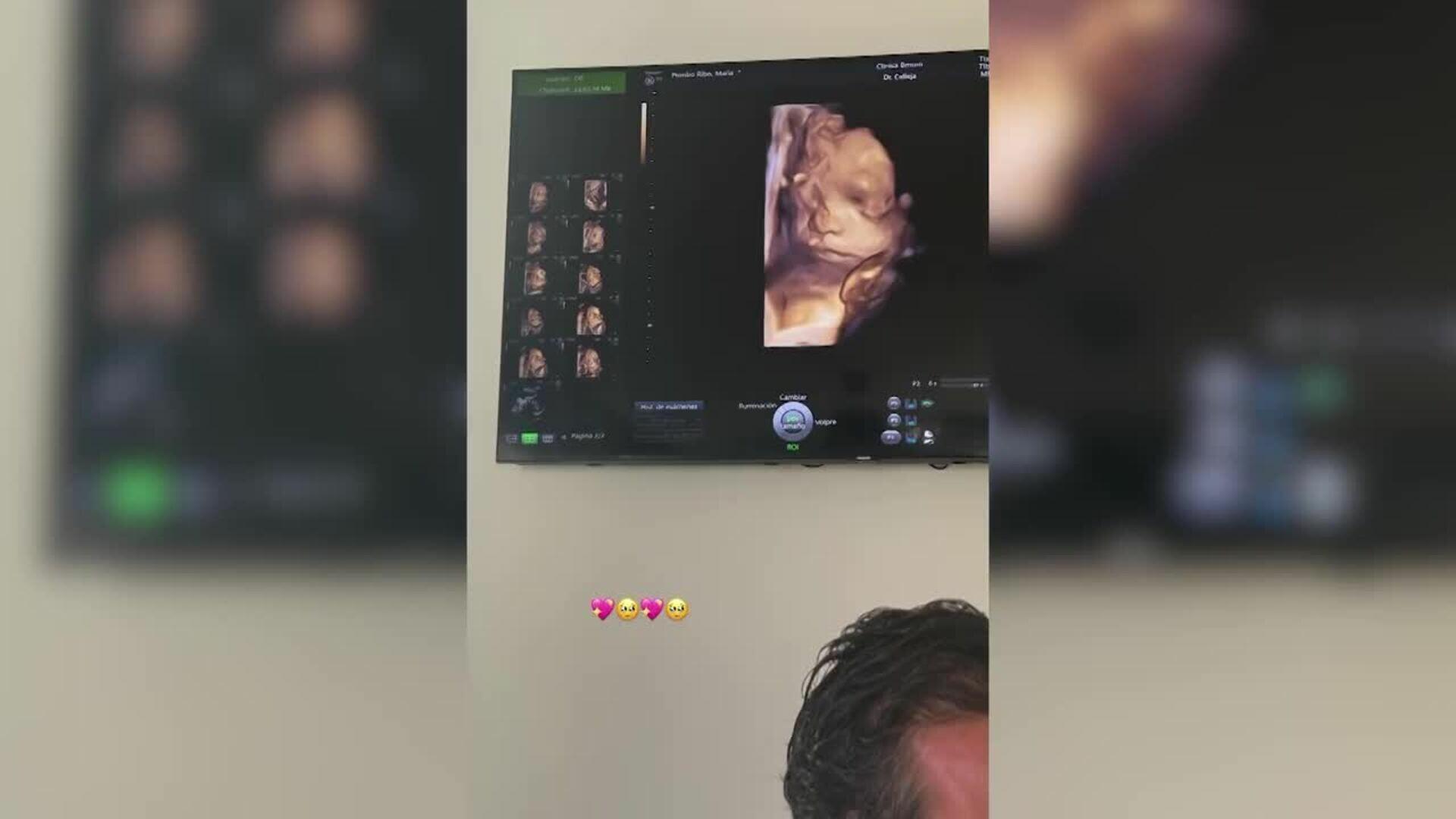 María Pombo se encuentra muy cansada por los síntomas de su tercer embarazo