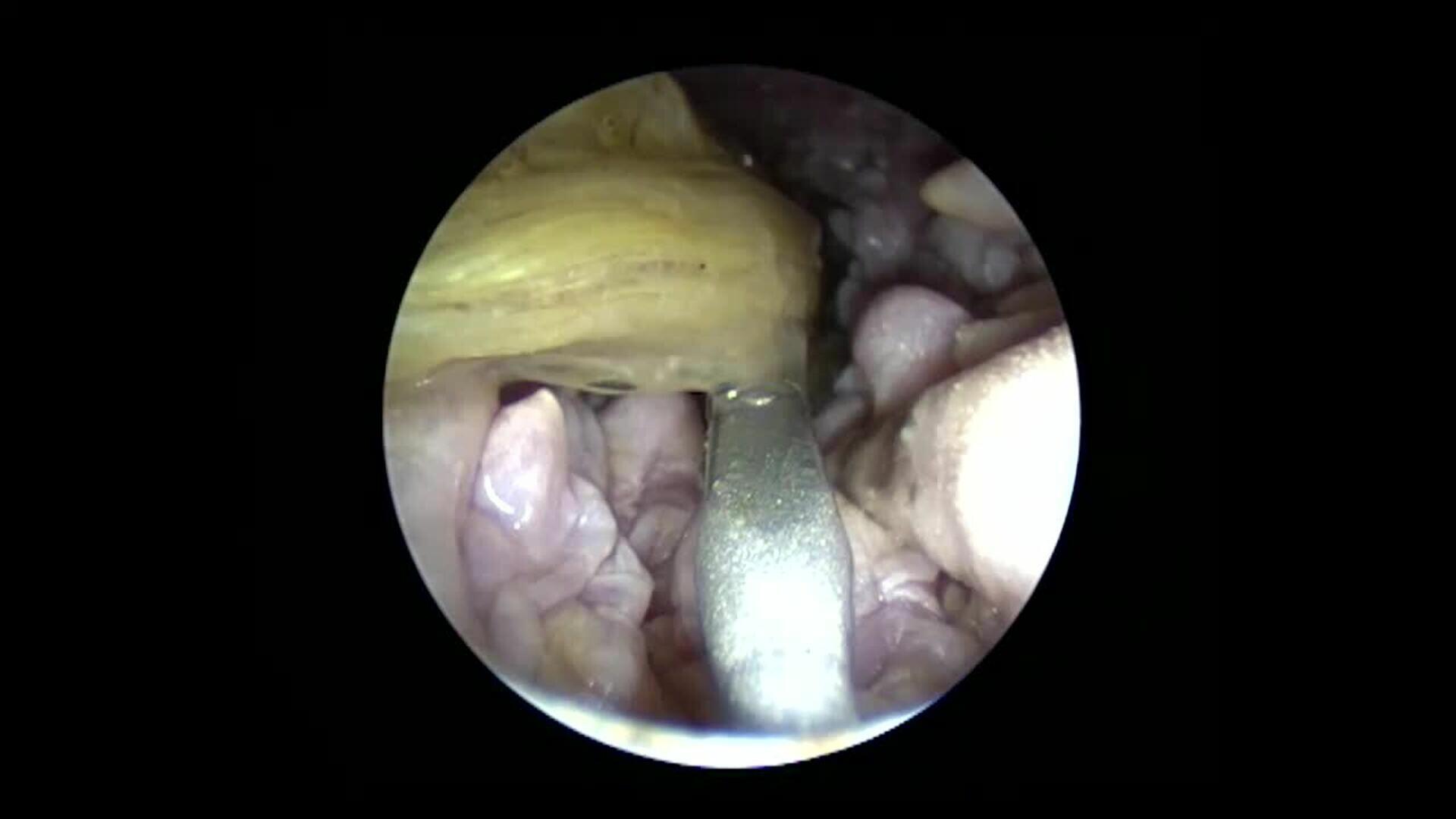 Una tortuga marina se recupera en el Oceanogràfic tras la amputación de una aleta