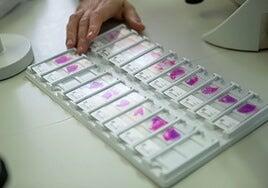 La difícil ruta de salvación para el paciente con sarcoma, un cáncer raro y mortal