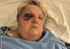 Agresión salvaje a una mujer de 71 años en Valencia por parte de dos jóvenes para robarle