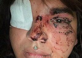 Una mujer trans denuncia ser brutalmente agredida por ocho personas en León