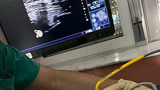 El hospital de La Candelaria aplica una técnica pionera contra el cáncer de mama en pacientes que no pueden operarse