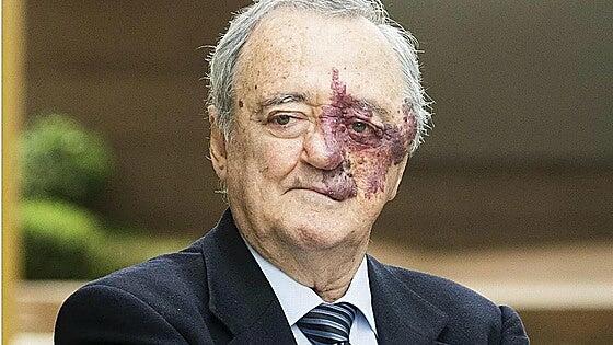 Barbacid se desvincula de la empresa que podría beneficiarse de su investigación sobre el cáncer de páncreas