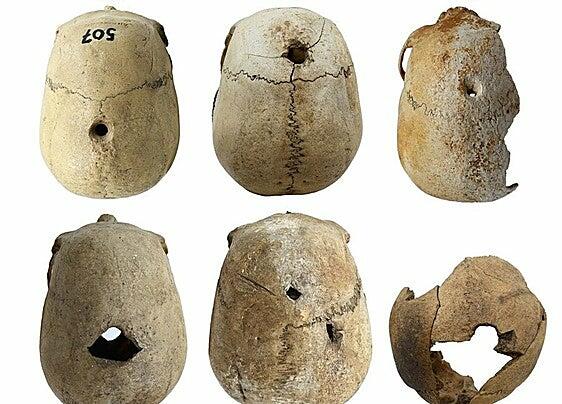 Los cráneos empalados de La Palma: El misterio arqueológico que desafía siglos de historia