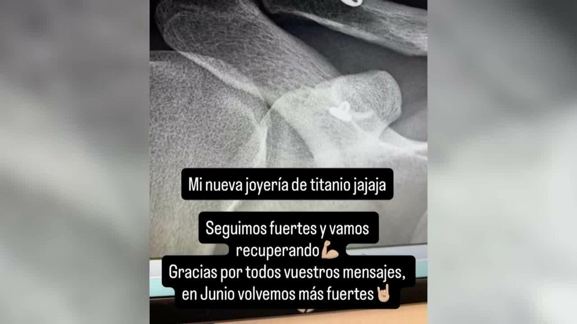 Dani Fernández continúa recuperándose de su aparatosa caída en el Roig Arena