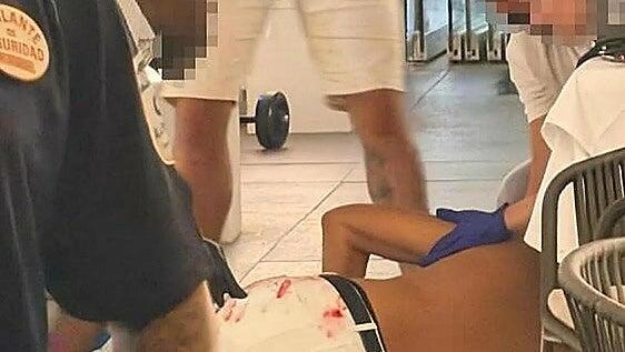 Una víctima de otro tiroteo en Málaga recibió un disparo en la cara: «Es un milagro que sobreviviera»
